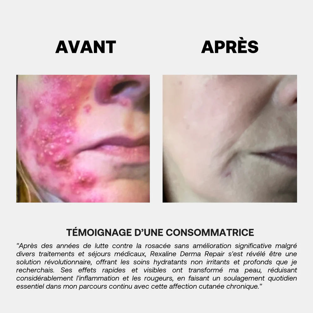 Rexaline DERMA REPAIR CREAM