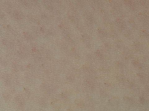 image comparison after