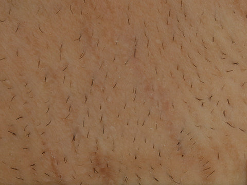 image comparison before