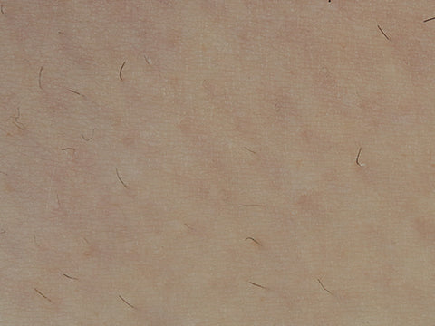 image comparison before